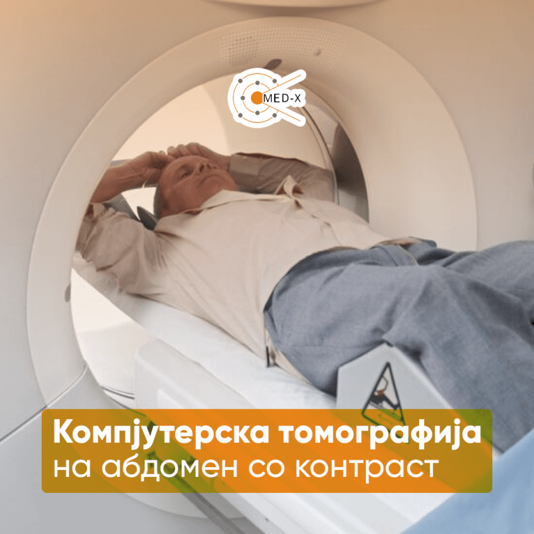 Компјутерска томографија на абдомен со контраст - MedX