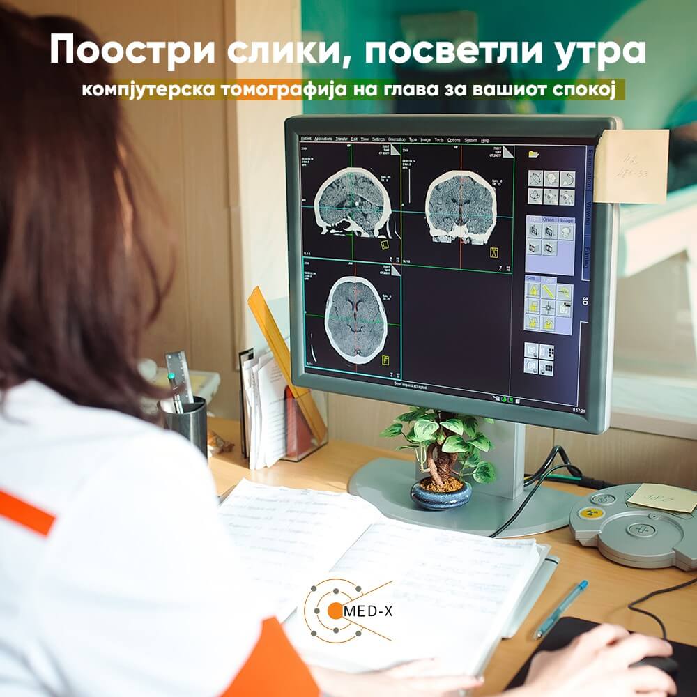 kompjuterska-tomografija-na-glava