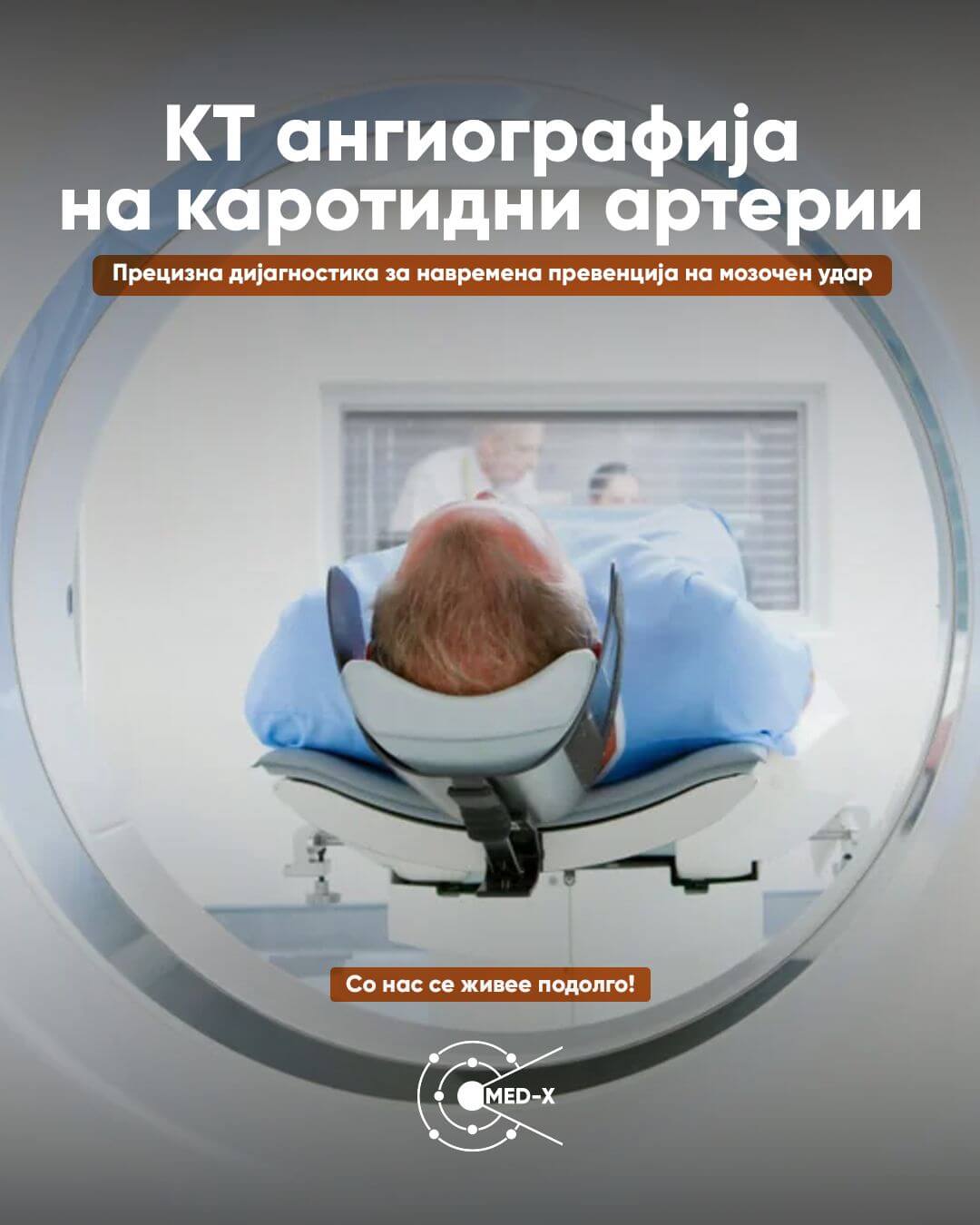 КТ ангиографија на каротидни артерии: Прецизна дијагностика за навремена превенција на мозочен удар