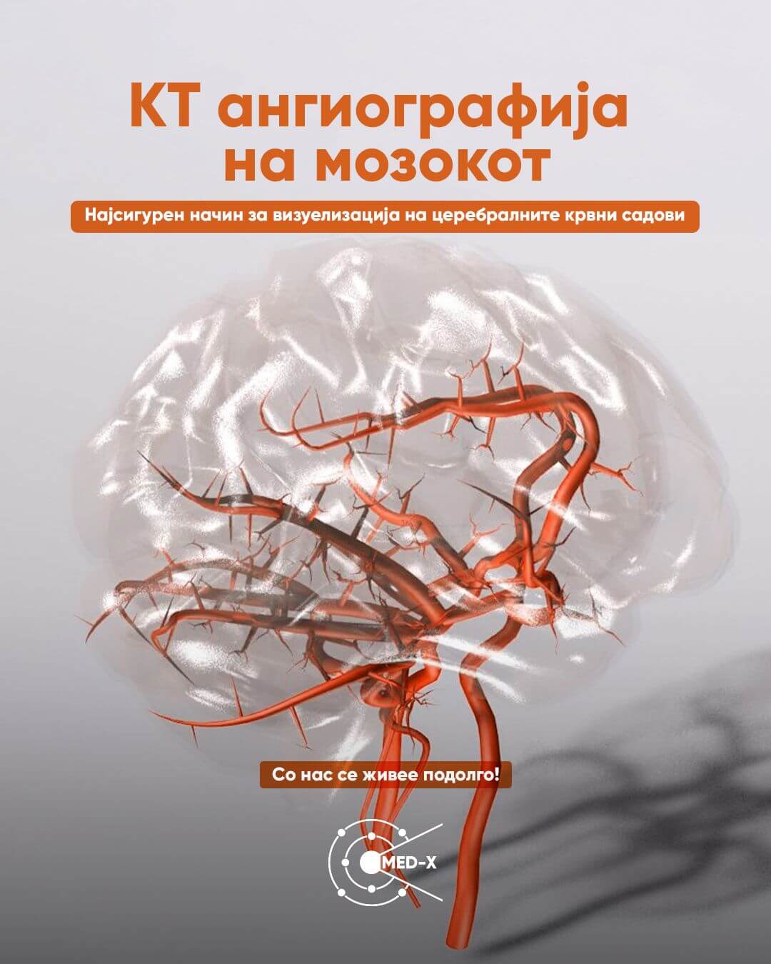 КТ ангиографија на мозокот